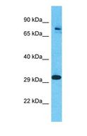 GALNT7 Antibody - Western blot of GALNT7 Antibody with human Jurkat Whole Cell lysate.  This image was taken for the unconjugated form of this product. Other forms have not been tested.