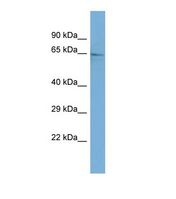 GALNT9 Antibody - Western blot of Human HepG2. GALNT9 antibody dilution 1.0 ug/ml.  This image was taken for the unconjugated form of this product. Other forms have not been tested.