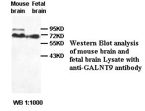 GALNT9 Antibody