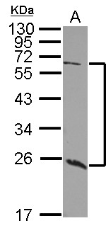 GALNT9 Antibody - Sample (30 ug of whole cell lysate) A: 293T 12% SDS PAGE GALNT9 antibody diluted at 1:1000