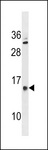 GALNTL5 Antibody - GALNTL5 Antibody western blot of human Uterus tissue lysates (35 ug/lane). The GALNTL5 antibody detected the GALNTL5 protein (arrow).