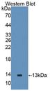 GALP / Alarin Antibody