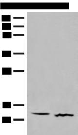 GALP / Alarin Antibody - Western blot analysis of Human fetal brain tissue and Mouse thymus tissue lysates  using GALP Polyclonal Antibody at dilution of 1:500