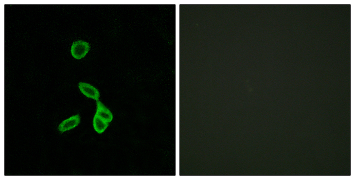 GALR1 / Galanin Receptor 1 Antibody - Immunofluorescence analysis of LOVO cells, using GALR1 Antibody. The picture on the right is blocked with the synthesized peptide.
