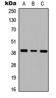 GALR1 / Galanin Receptor 1 Antibody - Western blot analysis of GALR1 expression in HEK293T (A); NS-1 (B); H9C2 (C) whole cell lysates.
