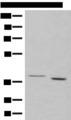 GALR1 / Galanin Receptor 1 Antibody - Western blot analysis of 293T cell lysates  using GALR1 Polyclonal Antibody at dilution of 1:500