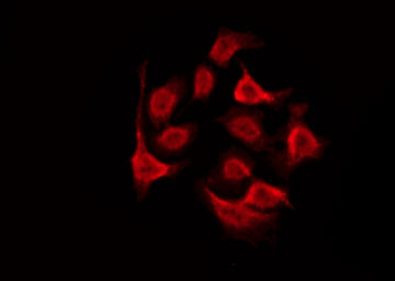 GALR2 / Galanin Receptor 2 Antibody - Staining RAW264.7 cells by IF/ICC. The samples were fixed with PFA and permeabilized in 0.1% Triton X-100, then blocked in 10% serum for 45 min at 25°C. The primary antibody was diluted at 1:200 and incubated with the sample for 1 hour at 37°C. An Alexa Fluor 594 conjugated goat anti-rabbit IgG (H+L) Ab, diluted at 1/600, was used as the secondary antibody.