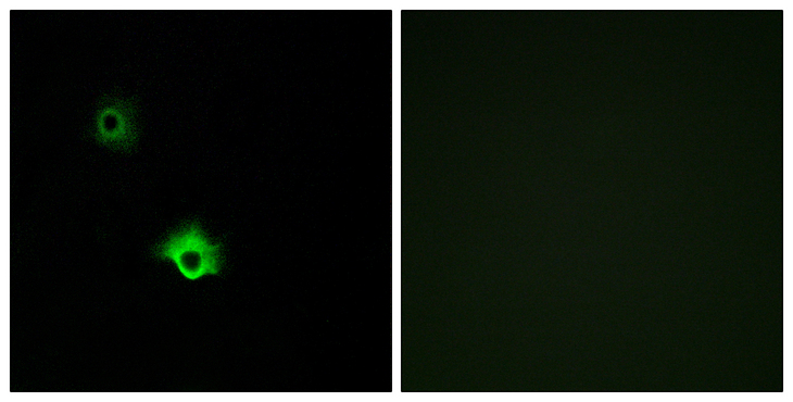 GALR3 / Galanin Receptor 3 Antibody - Immunofluorescence analysis of A549 cells, using GALR3 Antibody. The picture on the right is blocked with the synthesized peptide.