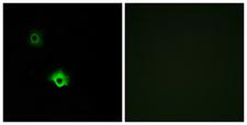 GALR3 / Galanin Receptor 3 Antibody - Immunofluorescence analysis of A549 cells, using GALR3 Antibody. The picture on the right is blocked with the synthesized peptide.