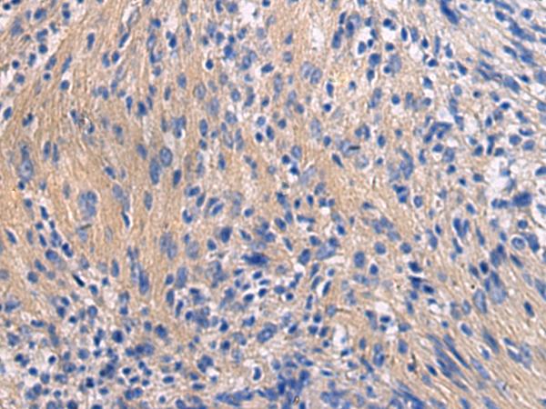 GALR3 / Galanin Receptor 3 Antibody - Immunohistochemistry of paraffin-embedded Human brain tissue  using GALR3 Polyclonal Antibody at dilution of 1:50(×200)