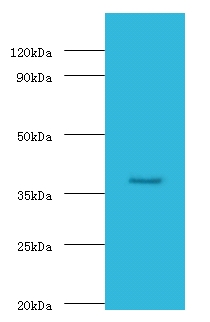 GALT Antibody - Western blot of GALT antibody at 2 ug/ml with mouse small intestine tissue Secondary Goat polyclonal to Rabbit IgG at 1:15000 dilution. Predicted band size: 43 KDa. Observed band size: 43 KDa.  This image was taken for the unconjugated form of this product. Other forms have not been tested.