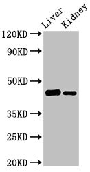 GALT Antibody - Western Blot Positive WB detected in: Rat liver tissue, Mouse kidney tissue All lanes: GALT antibody at 3µg/ml Secondary Goat polyclonal to rabbit IgG at 1/50000 dilution Predicted band size: 44, 32 kDa Observed band size: 44 kDa