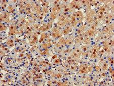 GALT Antibody - Immunohistochemistry of paraffin-embedded human adrenal gland tissue using GALT Antibody at dilution of 1:100