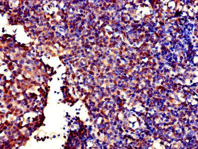 GALT Antibody - Immunohistochemistry of paraffin-embedded human tonsil tissue using GALT Antibody at dilution of 1:100