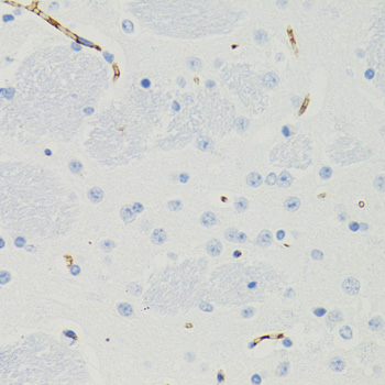 GALT Antibody - Immunohistochemistry of paraffin-embedded mouse brain tissue.