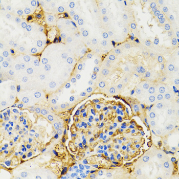 GALT Antibody - Immunohistochemistry of paraffin-embedded mouse kidney tissue.