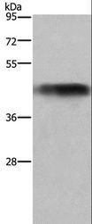 GALT Antibody - Western blot analysis of Human fetal liver tissue, using GALT Polyclonal Antibody at dilution of 1:300.