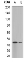 GALT Antibody - Western blot analysis of GALT expression in SKOV3 (A); HepG2 (B) whole cell lysates.