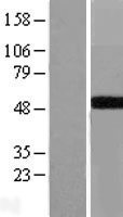 GALT Protein - Western validation with an anti-DDK antibody * L: Control HEK293 lysate R: Over-expression lysate