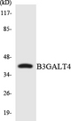 GALT4 / B3GALT4 Antibody - Western blot analysis of the lysates from 293 cells using B3GALT4 antibody.