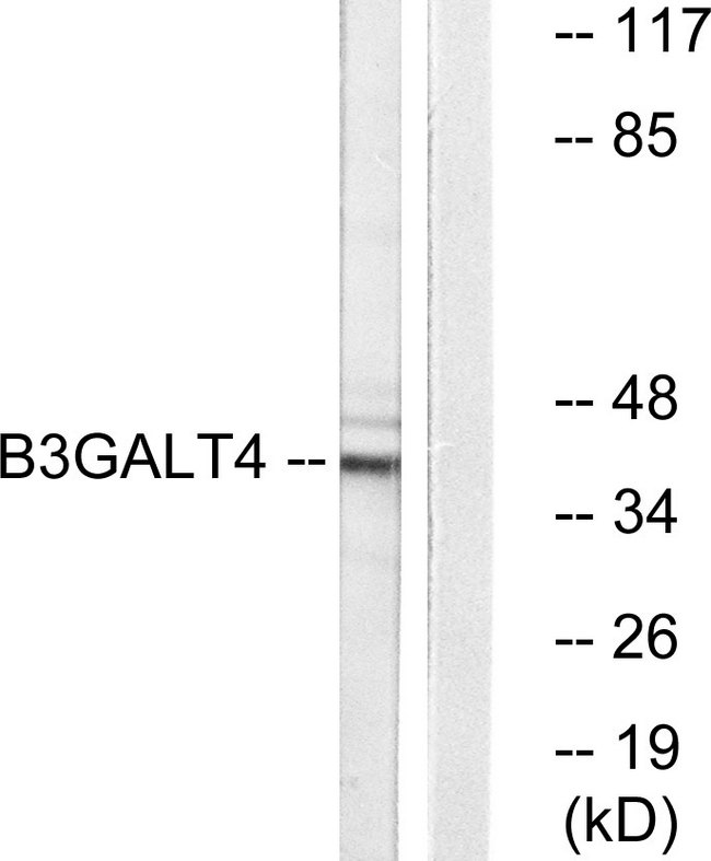 GALT4 / B3GALT4 Antibody - Western blot analysis of lysates from Jurkat cells, using B3GALT4 Antibody. The lane on the right is blocked with the synthesized peptide.