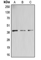 GALT4 / B3GALT4 Antibody - Western blot analysis of B3GALT4 expression in PC3 (A); Jurkat (B); U87MG (C) whole cell lysates.