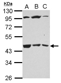 GALT4 / B3GALT4 Antibody - Sample (30 ug of whole cell lysate) A: PC-3 B: U87-MG C: SK-N-SH 10% SDS PAGE B3GALT4 antibody diluted at 1:1000