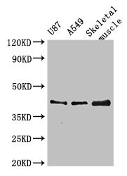 GALT4 / B3GALT4 Antibody - Western Blot Positive WB detected in:U87 whole cell lysate,A549 whole cell lysate,Mouse skeletal muscle tissue All Lanes:B3GALT4 antibody at 3µg/ml Secondary Goat polyclonal to rabbit IgG at 1/50000 dilution Predicted band size: 42 KDa Observed band size: 42 KDa