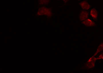 GALT4 / B3GALT4 Antibody - Staining HeLa cells by IF/ICC. The samples were fixed with PFA and permeabilized in 0.1% Triton X-100, then blocked in 10% serum for 45 min at 25°C. The primary antibody was diluted at 1:200 and incubated with the sample for 1 hour at 37°C. An Alexa Fluor 594 conjugated goat anti-rabbit IgG (H+L) Ab, diluted at 1/600, was used as the secondary antibody.