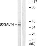 GALT4 / B3GALT4 Antibody - Western blot analysis of extracts from Jurkat cells, using B3GALT4 antibody.