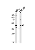 Gametogenetin / GGN Antibody - GGN Antibody western blot of A549, LNCaP cell line lysates (35 ug/lane). The GGN antibody detected the GGN protein (arrow).