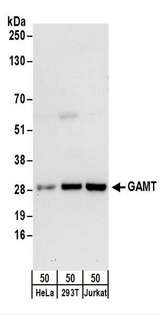 GAMT Antibody - Detection of Human GAMT by Western Blot. Samples: Whole cell lysate (50 ug) from HeLa, 293T, and Jurkat cells. Antibodies: Affinity purified rabbit anti-GAMT antibody used for WB at 0.4 ug/ml. Detection: Chemiluminescence with an exposure time of 30 seconds.
