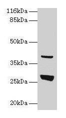 GAMT Antibody - Western blot All lanes: Guanidinoacetate N-methyltransferase antibody at 2µg/ml Lane 1: Mouse thymus tissue Lane 2: 293T whole cell lysate Lane 3: Jurkat whole cell lysate Secondary Goat polyclonal to rabbit IgG at 1/10000 dilution Predicted band size: 26 kDa Observed band size: 26 kDa