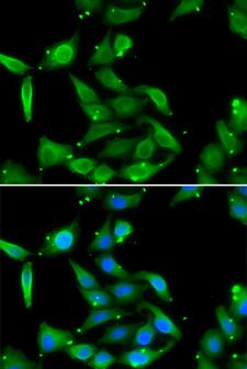 GAMT Antibody - Immunofluorescence analysis of U20S cells.