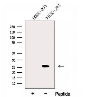 GAMT Antibody - Western blot analysis of extracts of HEK293 cells using GAMT antibody. The lane on the left was treated with blocking peptide.