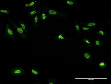 GAN Antibody - Immunofluorescence of monoclonal antibody to GAN on HeLa cell . [antibody concentration 10 ug/ml]