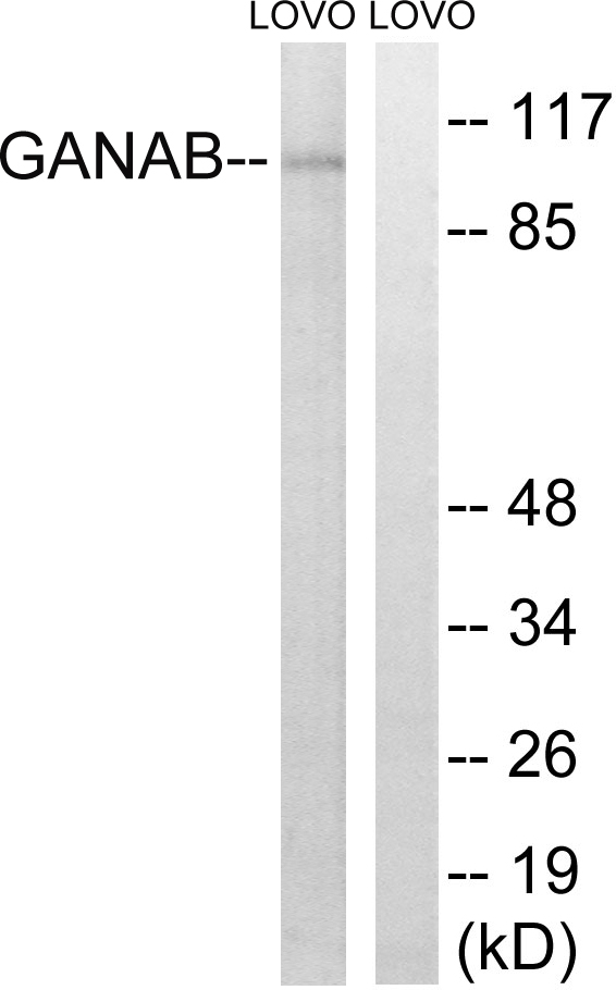 GANAB / Alpha Glucosidase II Antibody - Western blot analysis of lysates from LOVO cells, using GANAB Antibody. The lane on the right is blocked with the synthesized peptide.