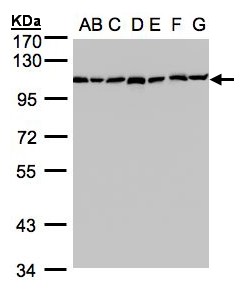 GANAB / Alpha Glucosidase II Antibody - Sample (30 ug whole cell lysate). A:293T, B: A431 , C: H1299, D: HeLa S3 , E: Hep G2 . F: MOLT4 . G: Raji . 7.5% SDS PAGE. GANAB / Alpha Glucosidase II antibody diluted at 1:1000