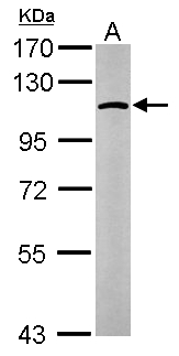 GANAB / Alpha Glucosidase II Antibody - Sample (50 ug of whole cell lysate). A: Mouse brain. 7.5% SDS PAGE. GANAB / Alpha Glucosidase II antibody diluted at 1:1000.