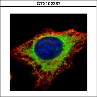 GANAB / Alpha Glucosidase II Antibody - Confocal immunofluorescence analysis (Olympus FV10i) of methanol-fixed HeLa using alpha Glucosidase II antibody (Green) at 1:500 dilution. Alpha-tubulin filaments were labeled with alpha-tubulin antibody (Red) at 1:2000.