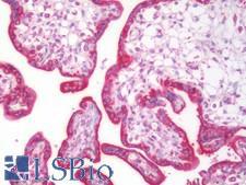 GANAB / Alpha Glucosidase II Antibody - Human Placenta: Formalin-Fixed, Paraffin-Embedded (FFPE)
