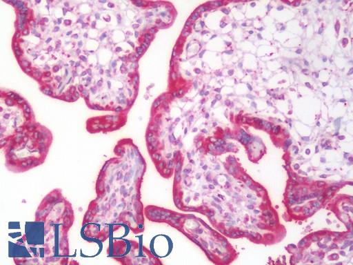 GANAB / Alpha Glucosidase II Antibody - Human Placenta: Formalin-Fixed, Paraffin-Embedded (FFPE)