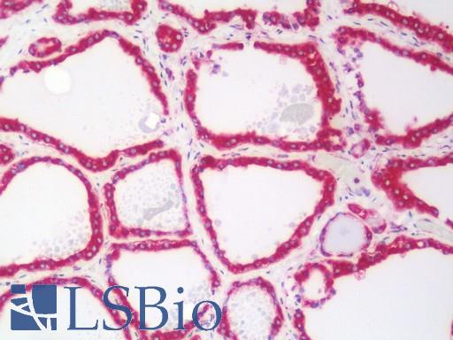 GANAB / Alpha Glucosidase II Antibody - Human Thyroid: Formalin-Fixed, Paraffin-Embedded (FFPE)