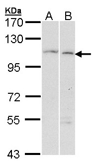 GANAB / Alpha Glucosidase II Antibody - Sample (30 ug of whole cell lysate). A: Hela, B: Molt-4 . 7.5% SDS PAGE. GANAB / Alpha Glucosidase II antibody diluted at 1:1000.