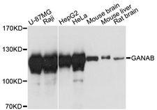 GANAB / Alpha Glucosidase II Antibody - Western blot analysis of extracts of various cell lines, using GANAB antibody at 1:3000 dilution. The secondary antibody used was an HRP Goat Anti-Rabbit IgG (H+L) at 1:10000 dilution. Lysates were loaded 25ug per lane and 3% nonfat dry milk in TBST was used for blocking. An ECL Kit was used for detection and the exposure time was 10s.