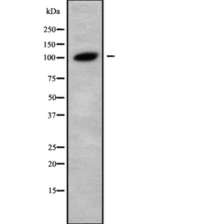 GANAB / Alpha Glucosidase II Antibody - Western blot analysis Glucosidase II alpha using LOVO cells whole cells lysates