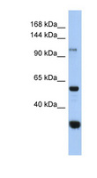 GANC Antibody - GANC antibody Western blot of HeLa lysate. This image was taken for the unconjugated form of this product. Other forms have not been tested.