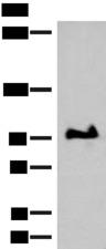 GANC Antibody - Western blot analysis of TM4 cell lysate  using GANC Polyclonal Antibody at dilution of 1:550