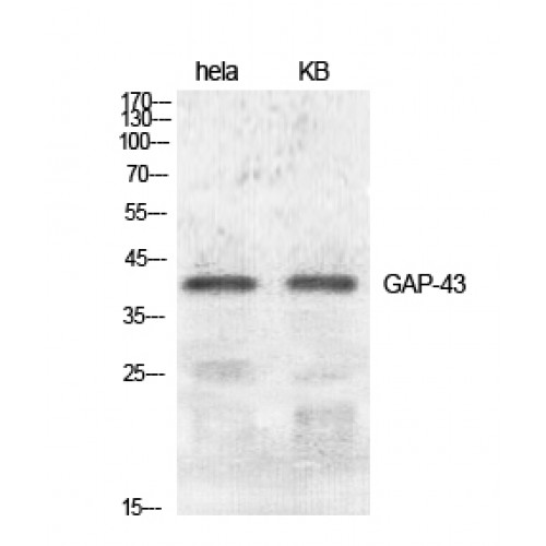 GAP43 Antibody - Western blot of GAP-43 antibody