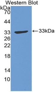 GAP43 Antibody - Western blot of recombinant GAP43.